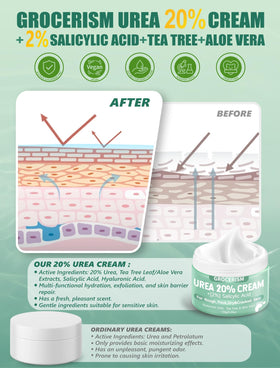 Grocerism foot cream application on dry skin