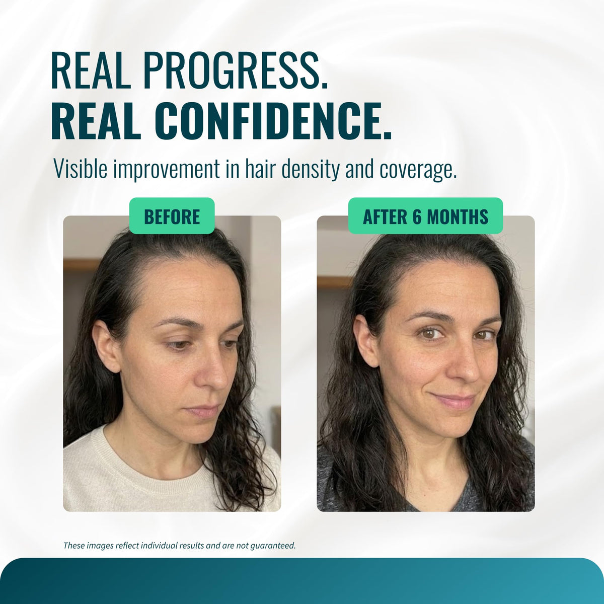 Growth Essence Minoxidil 5% Cream outer box packaging