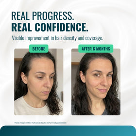 Growth Essence Minoxidil 5% Cream outer box packaging