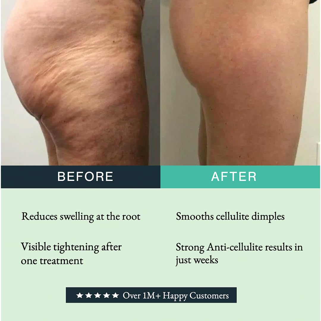 Guam Anti-Cellulite Mud Cold Formula in use during spa