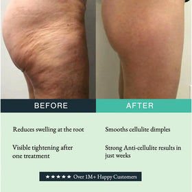 Guam Anti-Cellulite Mud Cold Formula in use during spa