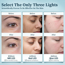 GYH LED Face Mask in use on a model's face