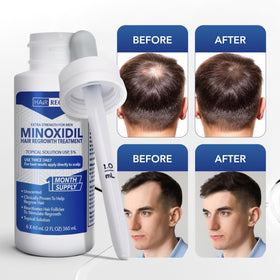 Hair Regen Minoxidil Liquid 5% product details