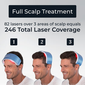 Hairmax LaserBand 82 showing full scalp coverage