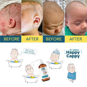 Happy Cappy Medicated Shampoo and Body Wash lifestyle scene with child