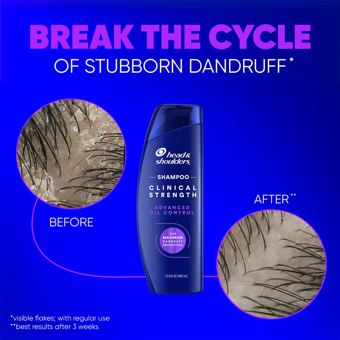 Head & Shoulders Clinical Strength Anti-Dandruff Shampoo with ingredients list
