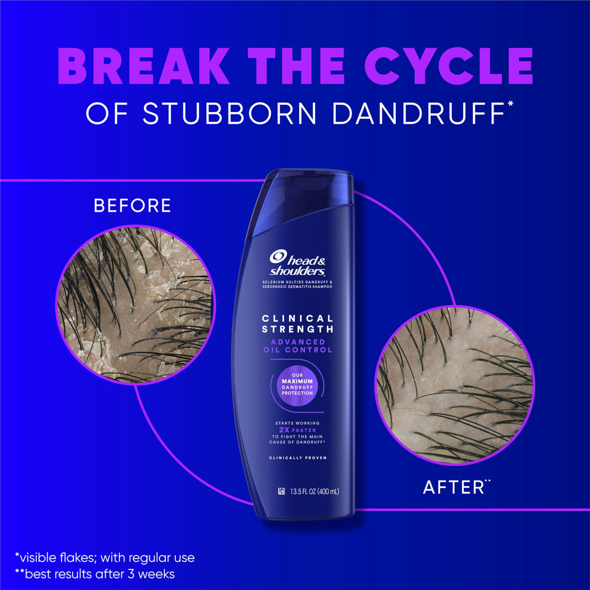 Head & Shoulders Clinical Strength Shampoo in a bathroom setting