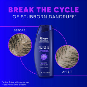 Head & Shoulders Clinical Strength Shampoo in a bathroom setting