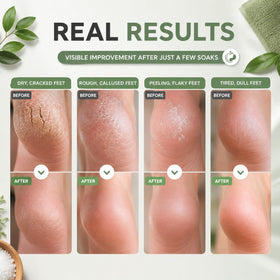HEAMAVIN Tea Tree Oil Foot Soak in warm water bath
