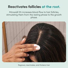 HIMS & HERS Hair Regrowth 5% Foam application on scalp