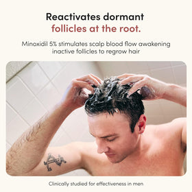 HIMS & HERS Hair Regrowth 5% Minoxidil foam application