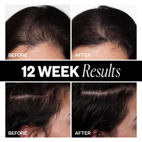 IGK Hair Density Scalp in lifestyle setting