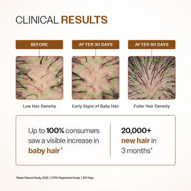 Ingredients of Bare Anatomy Advanced Hair Growth Serum