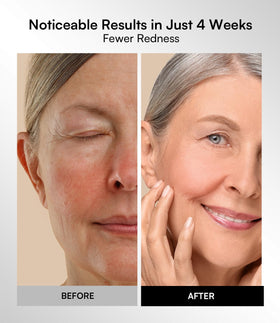 INIA Red Light Therapy Mask packaging and instructions
