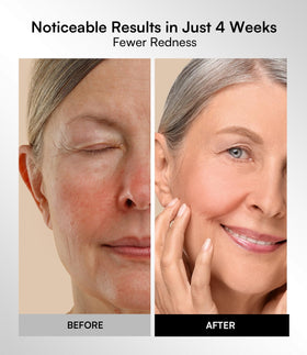 INIA Red Light Therapy Mask packaging with product details