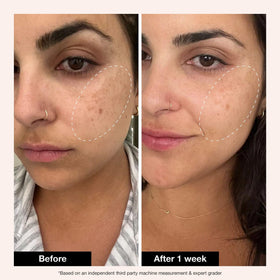 Innbeauty Project Retinol Remix 1% Serum packaging display