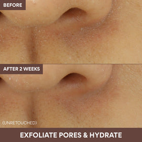 innisfree Volcanic Swirl Pore Mask before and after results on skin