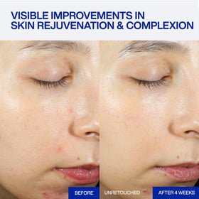 IOPE Expert PDRN Caffeine Shot Serum application on hand
