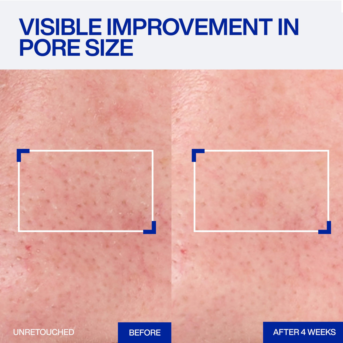 IOPE Expert Retinol RX 1% Super Bounce Serum on a bathroom counter