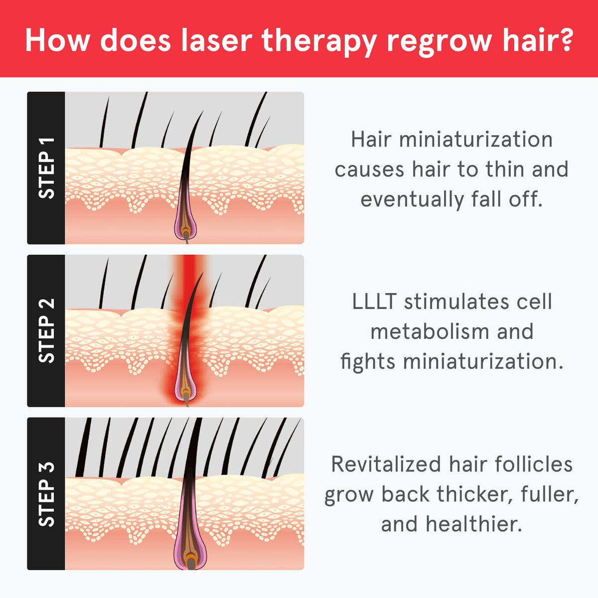 iRestore Essential Laser Hair Growth Cap accessories