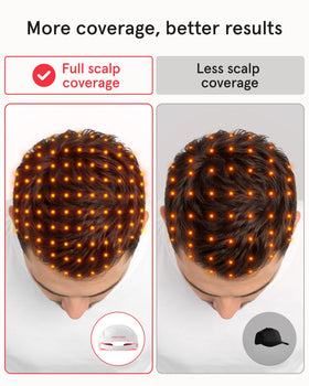 iRestore Essential Laser Hair Growth Cap close-up