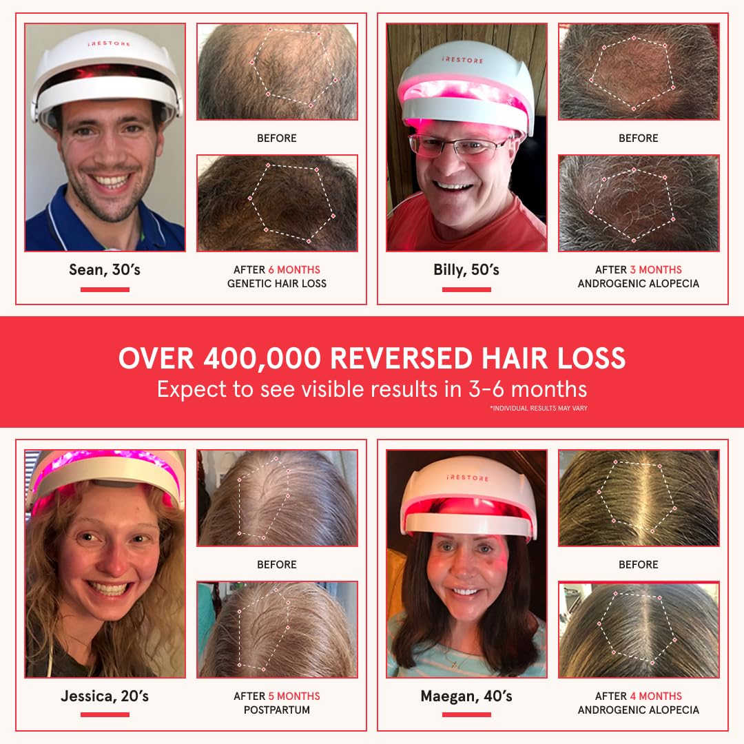 iRestore Essential Laser Hair Growth Cap side view