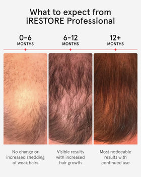 iRestore Professional Laser Hair Growth System in use at home