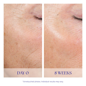 iS CLINICAL Active Peel System ingredients list close-up