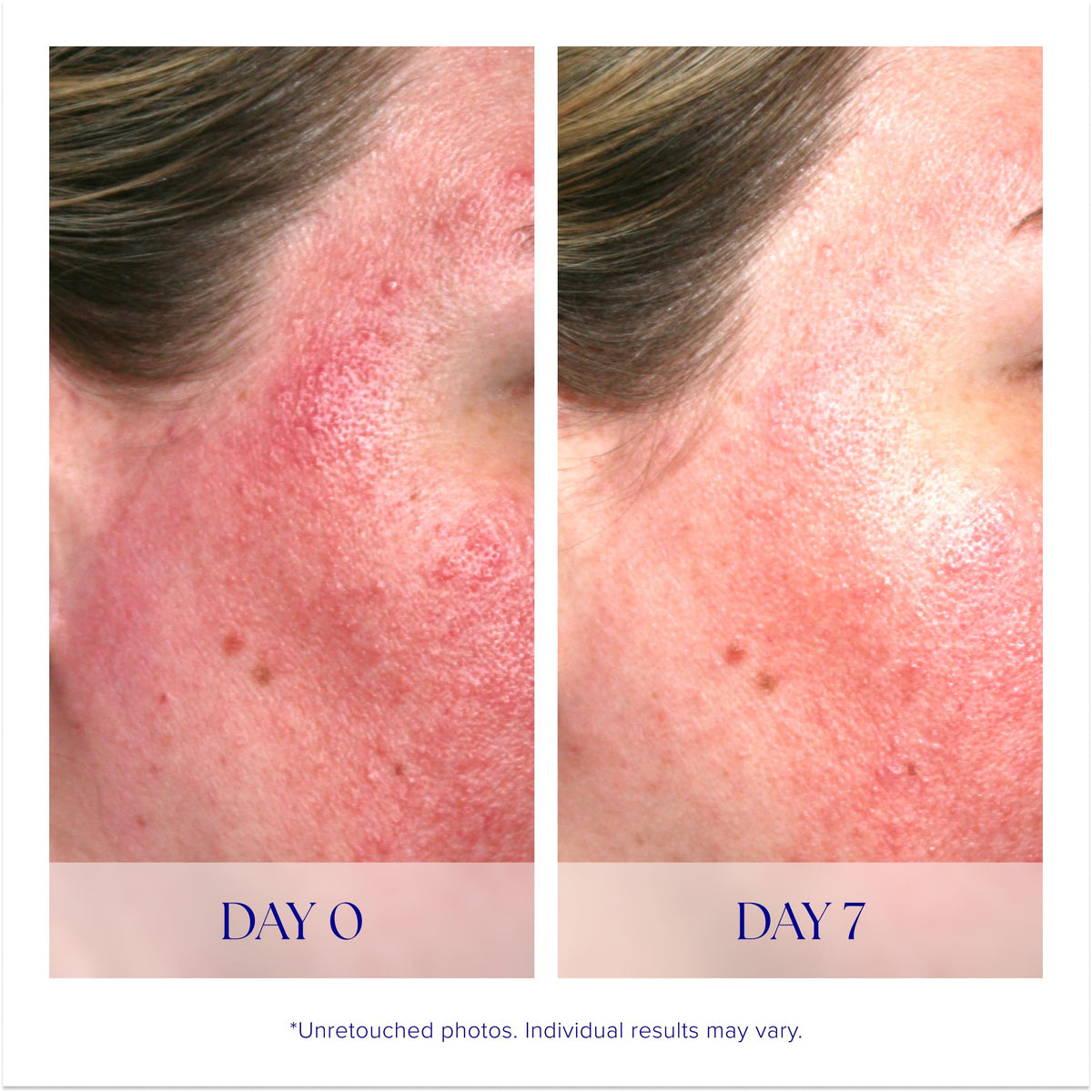 iS CLINICAL Pro-Heal Serum Advance+ application on skin