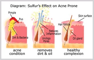 JOESOEF SKIN CARE Sulfur Soap next to other skincare products
