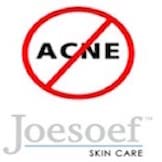 JOESOEF Sulfur Acne Soap 100g bar on a soap dish