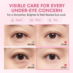 Johohula PDRN Collagen Stick and Eye Patches together
