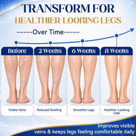 JOYAONE Varicose Veins Cream 150g side view