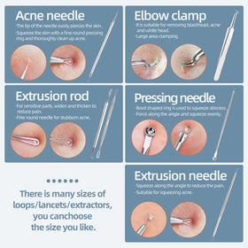 JPNK Blackhead Remover Kit tools arranged on a flat surface