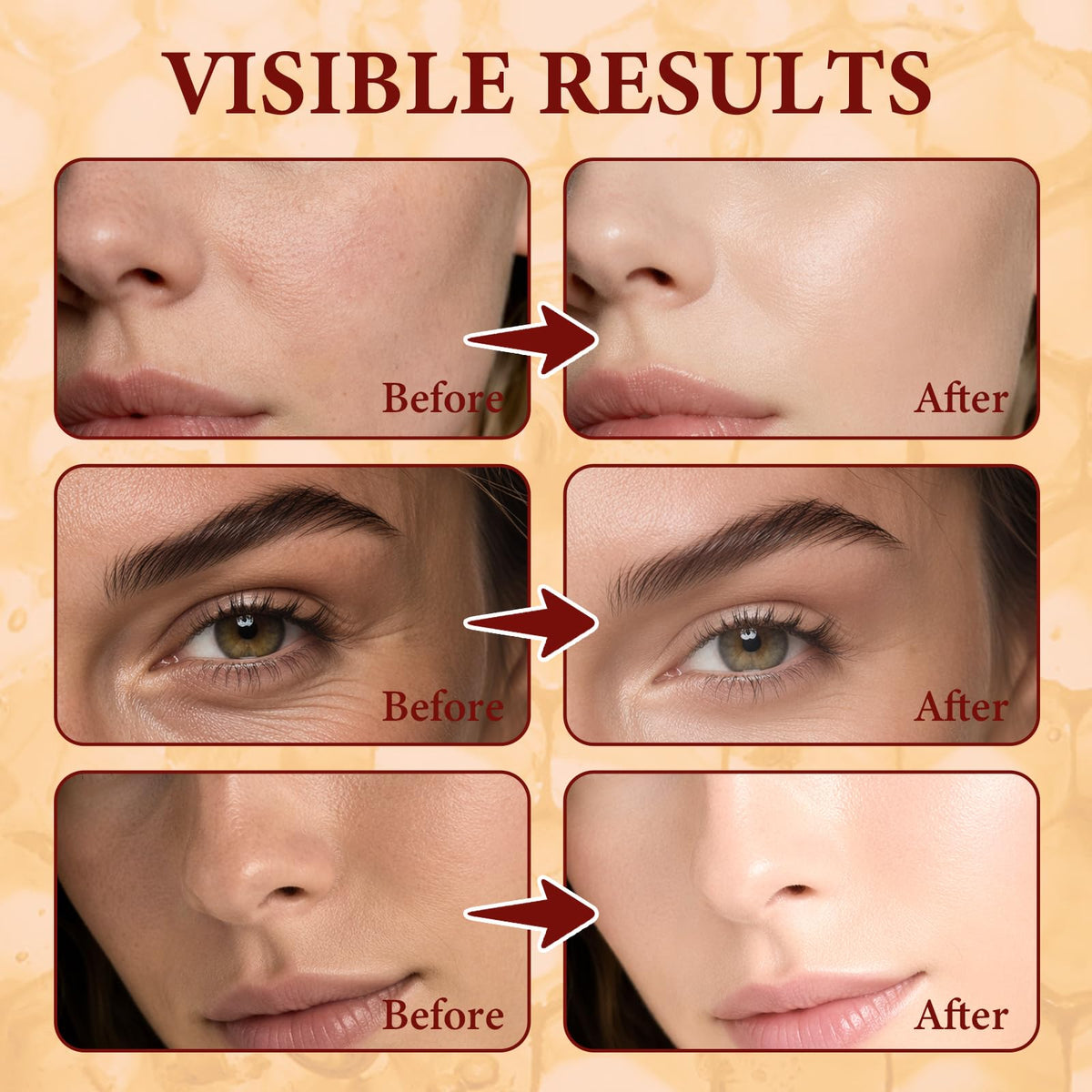 Kallteren Bee Venom Skin Cream application on skin