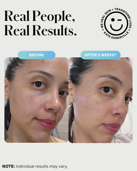 Kate Somerville EradiKate cleanser with ingredients list