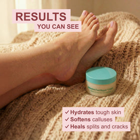 Kerasal Intensive Foot Repair Cream 4 oz jar side view