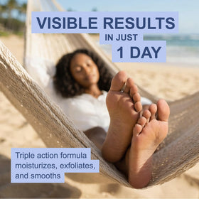 Kerasal Intensive Foot Repair Ointment application on feet