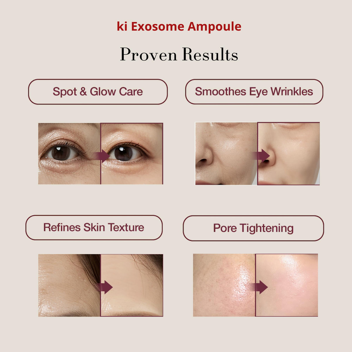 ki cosmetics Stem-Cell Exosome Skin support Kit packaging