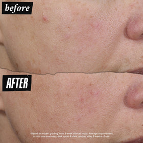 Kiehl's Auto-Tone UV Solution Serum application on skin