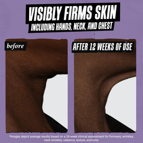 Kiehl's Retinol Serum bottle with a soft focus background