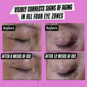 Kiehl's Super Multi-Corrective Eye Cream texture close-up