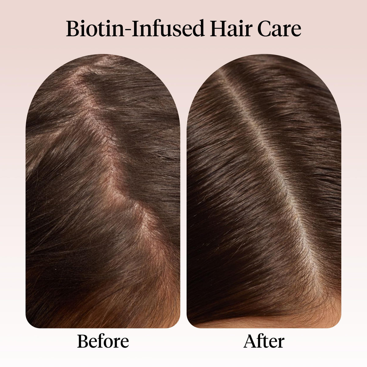 Kitsch Rosemary Oil application on scalp