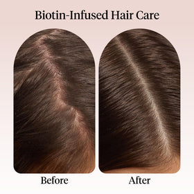 Kitsch Rosemary Oil application on scalp