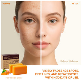KlearBloom Kojic Acid Soap Bar showing texture