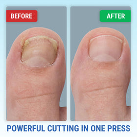 KLIPP Toenail Clippers displayed on a wooden surface