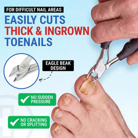 KLIPP Toenail Clippers showing 15 mm wide jaw for thick nails