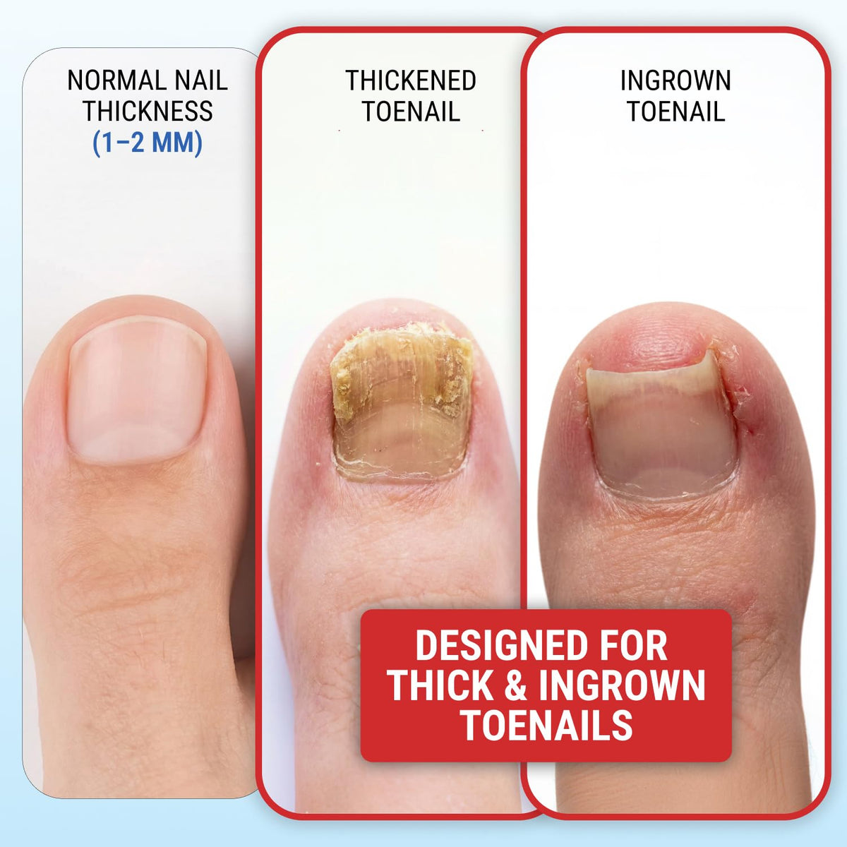 KLIPP Toenail Clippers side view highlighting ergonomic design