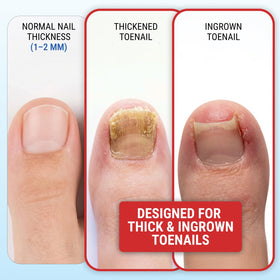 KLIPP Toenail Clippers side view highlighting ergonomic design