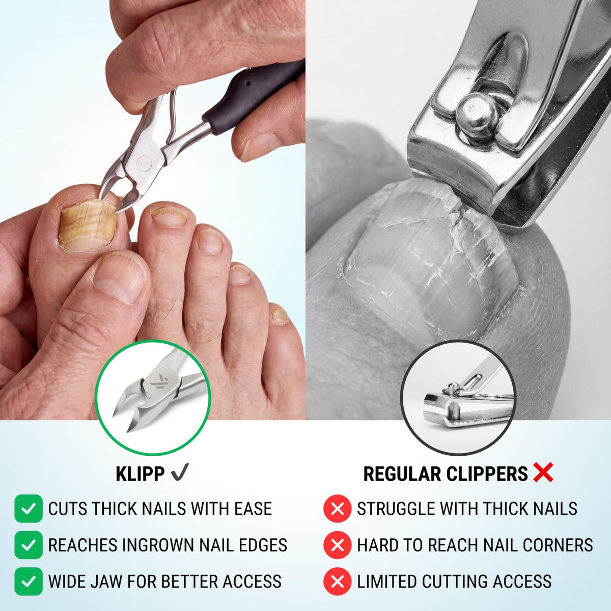KLIPP Toenail Clippers with a hand demonstrating use